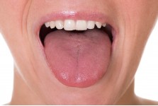 DRY MOUTH